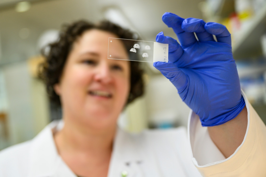 Kirstan Gimse examines a slide in the lab