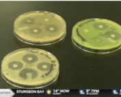petri dishes featuring zones of inhibition