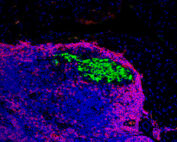 An immunofluorescence image of mice pancreatic cells (green) and immune cells (blue)