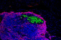 An immunofluorescence image of mice pancreatic cells (green) and immune cells (blue)