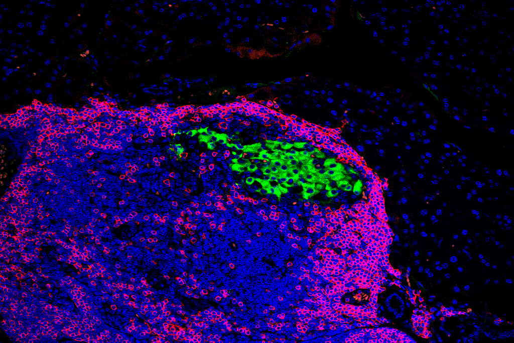 An immunofluorescence image of mice pancreatic cells (green) and immune cells (blue)