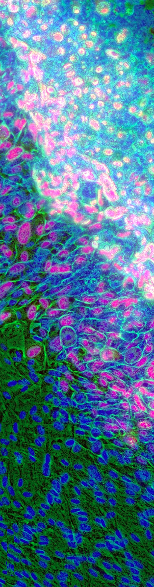 endothelial cells in florescent stain