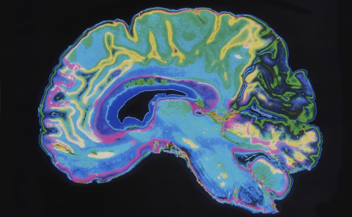 image of human brain cross section. very colorful